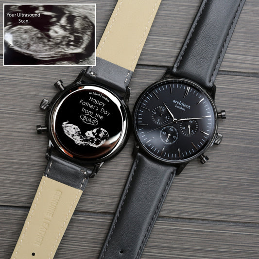 Two watches with black faces and leather straps on a wooden surface, one showing an ultrasound image.